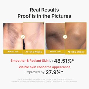 Alternative view of Medicube Kojic Acid Turmeric body Peel Shot
