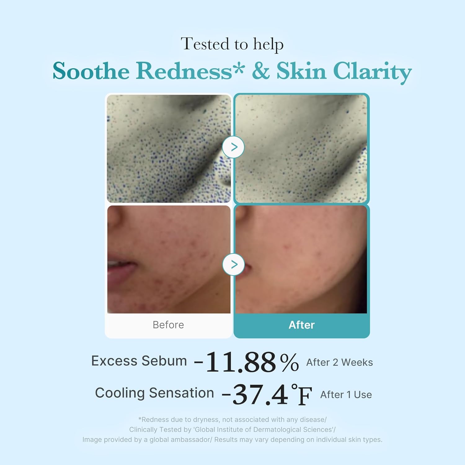 Medicube Azelaic acid niacinamide clear toner - Image 4