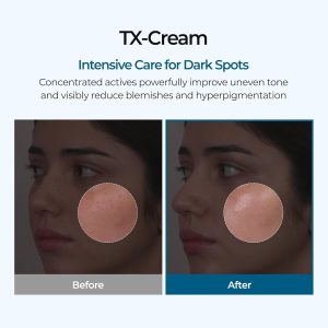 Alternative view of Dr.Melaxin TX-Tranexamic Acid Cream