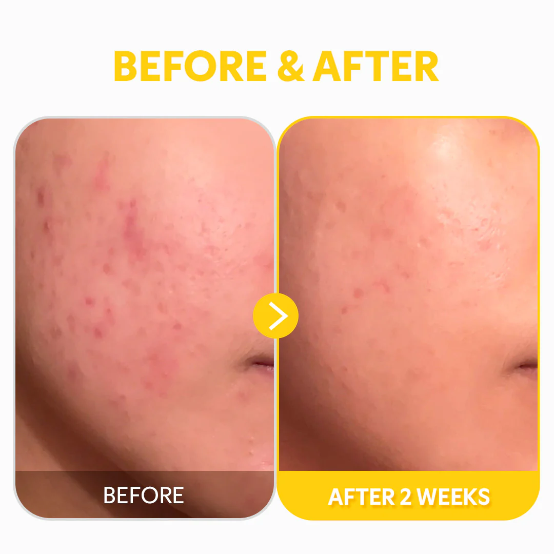 TIR TIR Pure Vitamin C24 Serum - Image 8