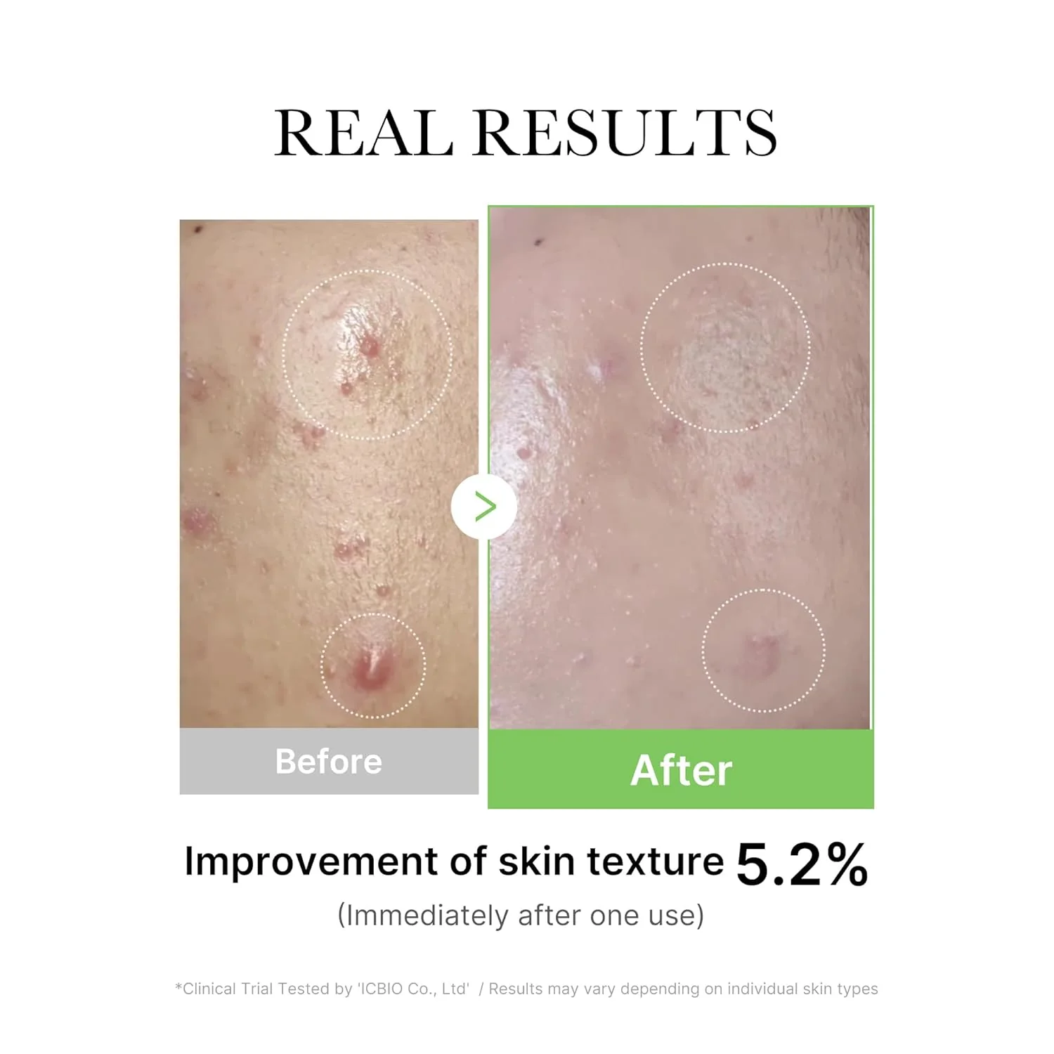 Medicube Exosome CICA Serum - Image 5