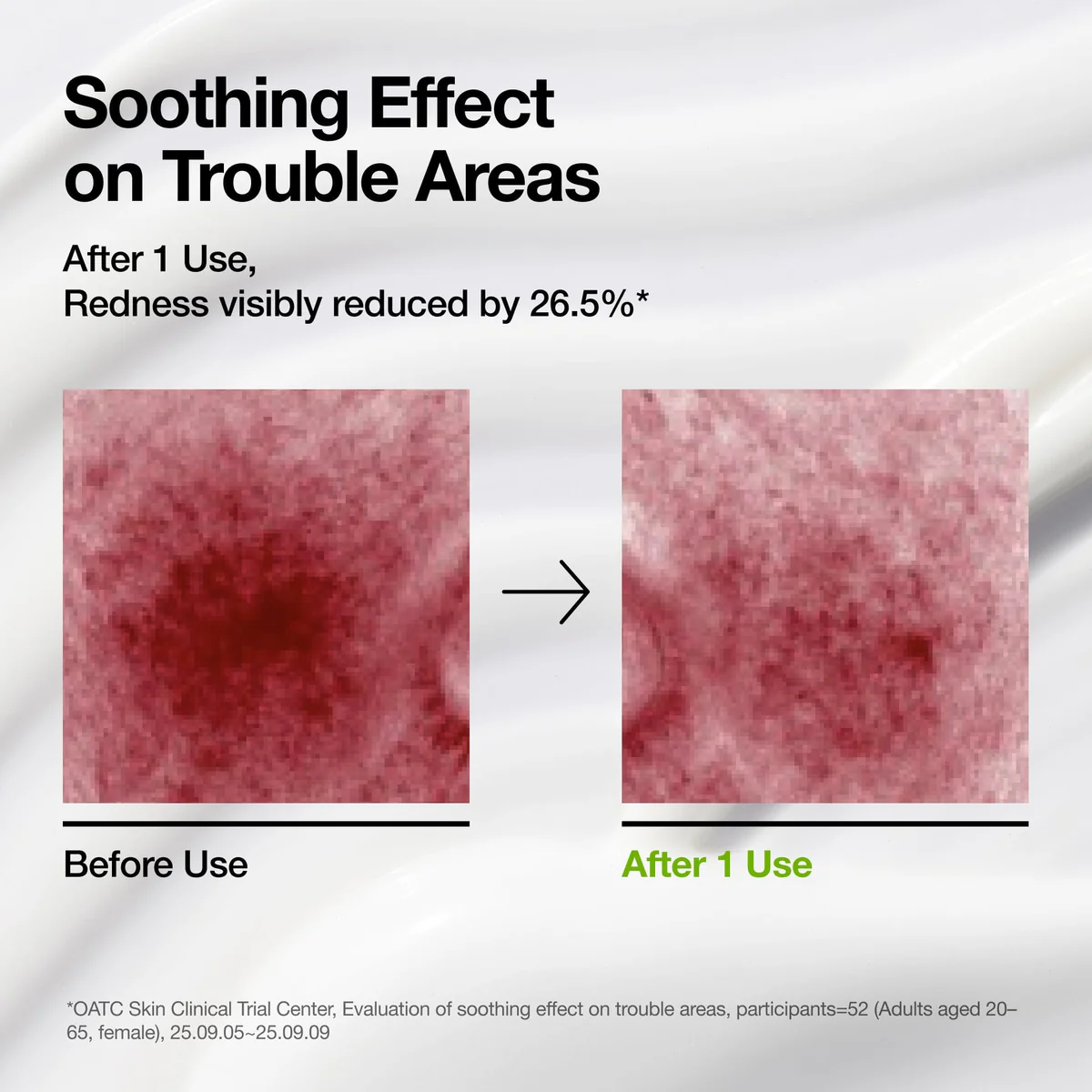 ANUA Azelaic Acid CICA Skin Soothing Moisturizer - Image 3