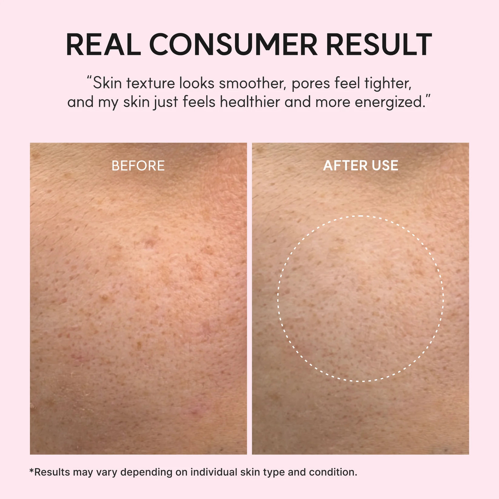 Arencia PDRN Booster Shot Serum - Image 8